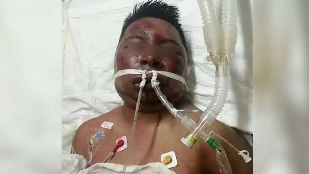 Así quedó el asaltante que fue linchado en la combi