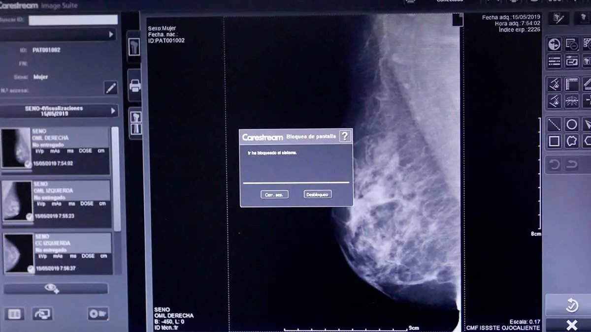 Cáncer de mama afecta a hombres y mujeres
