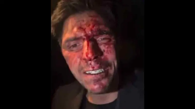 VIDEO: Golpean al hijo de Lupita DAlessio; acusa a exgobernador del PRI