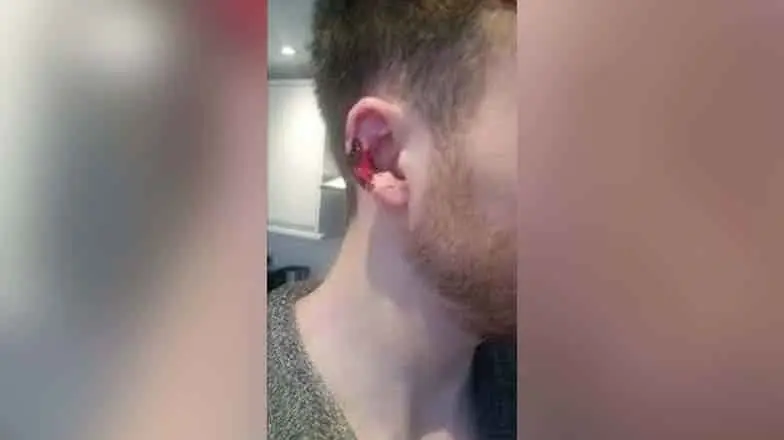 Novia celosa le arranca parte de oreja a su novio en Hermosillo
