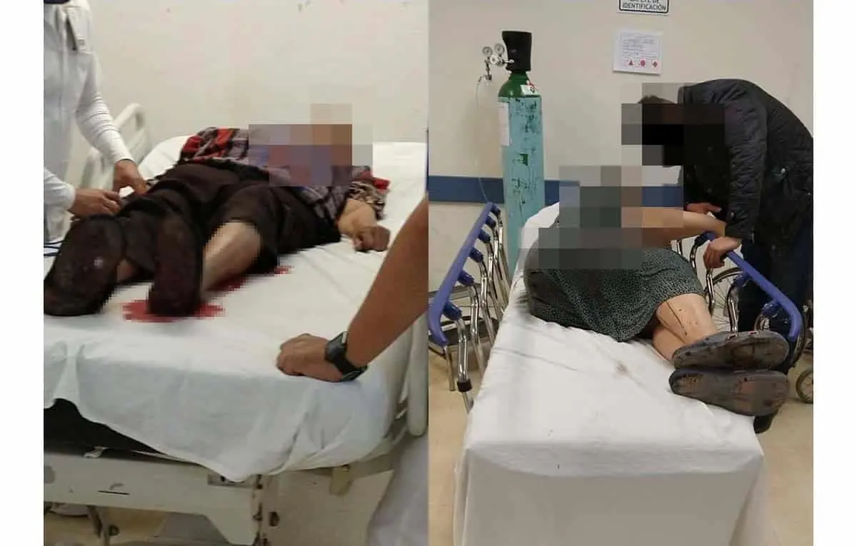 Resultan dos abuelitas lesionadas en ataque armado en Plano Oriente