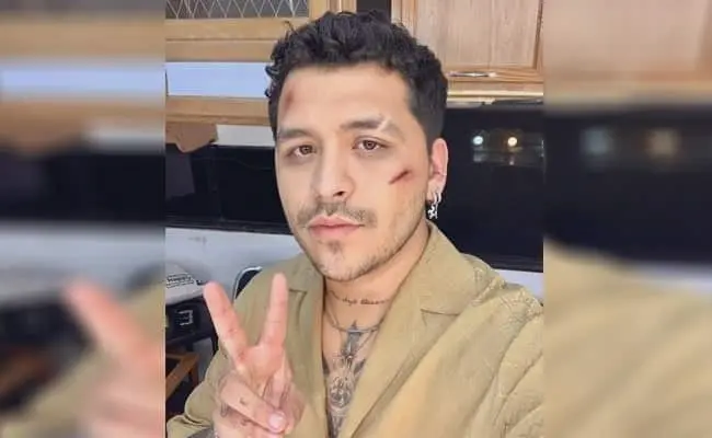 Con golpes en el rostro aparece Christian Nodal