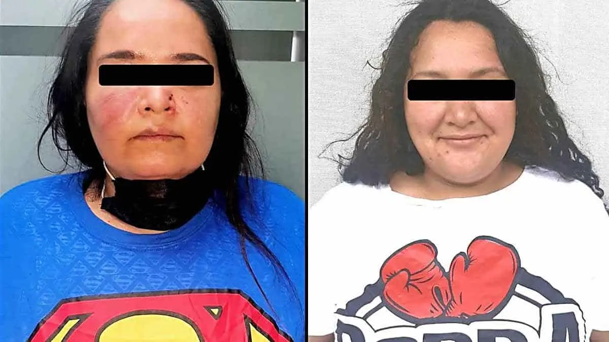 Por deuda de 60 pesos se traman a golpes y pierden hasta un diente