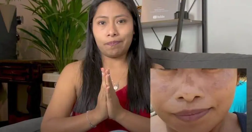 Yalitza Aparicio habla sobre su enfermedad