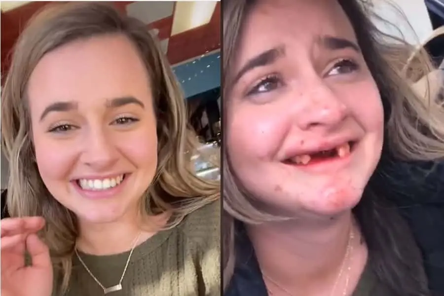 Video. Joven se emborracha para grabar TikTok y se tumba los dientes