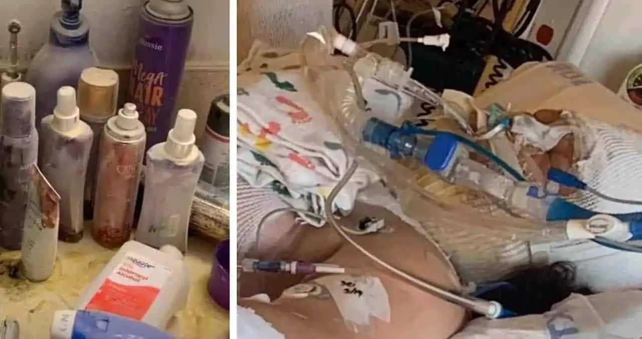 Termina en hospital con quemaduras severas por reto en Tik Tok