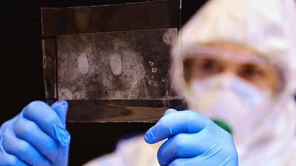 Investigación del forense está rebasada