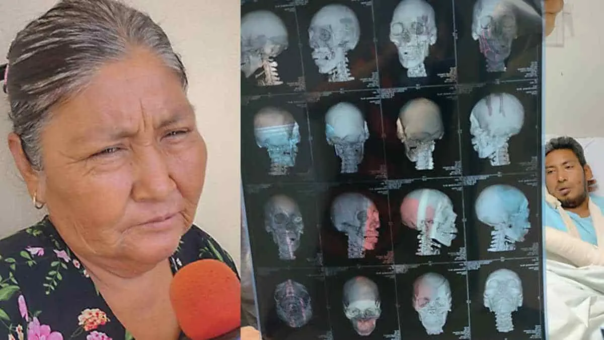 Por fin operan a su hijo Luis