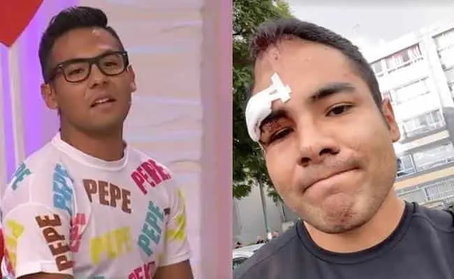 Participante de "Enamorándonos" brutalmente golpeado por sus vecinos
