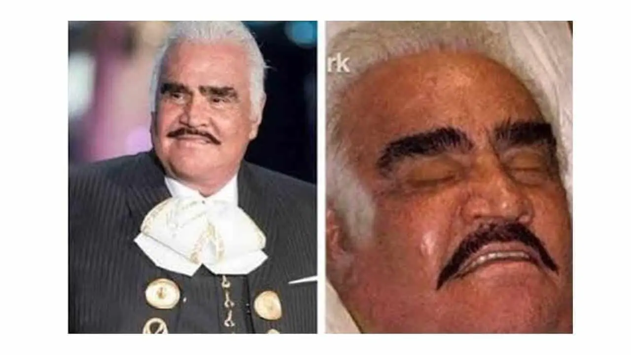 Confirman que Vicente Fernández  padece Síndrome de Guillan-Barré