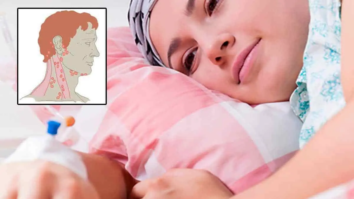 Sonora tiene mayor prevalencia de leucemia linfática