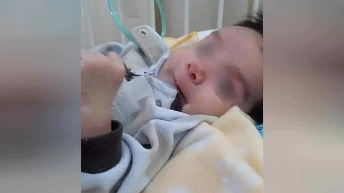 Bebé yaqui se recupera tras complicada y riesgosa cirugía