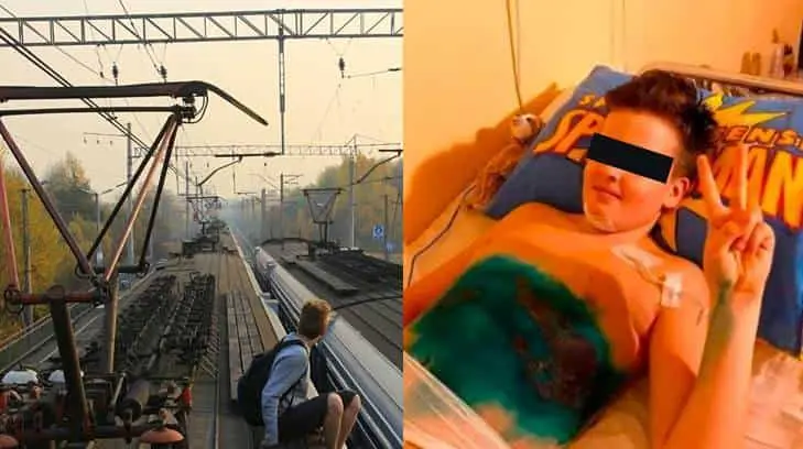 VIDEO. Niño pierde las piernas tras cumplir un reto viral