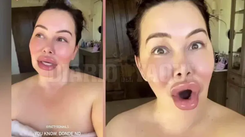 Chiquis Rivera desata polémica por exceso de bótox Chiquis Rivera desata polémica por exceso de bótox