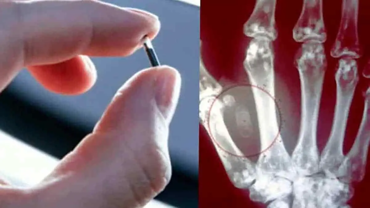 Microchip en la mano simplifica la vida de los suecos
