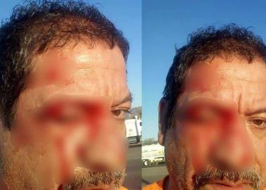 Golpean a trailero en bloqueo de Loma de Guamúchil