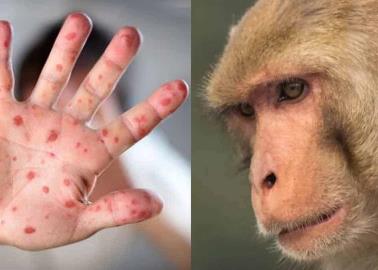 Registran primer caso de viruela del mono en México Registran primer caso de viruela del mono en México