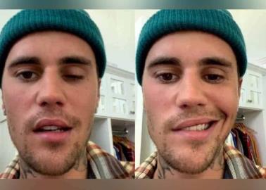 VIDEO. Justin Bieber sufre parálisis facial