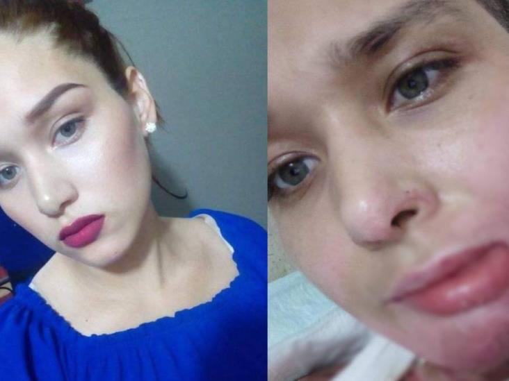 VIDEO. Fue secuestrada, violada y quemada viva; exige justicia VIDEO. Fue secuestrada, violada y quemada viva; exige justicia