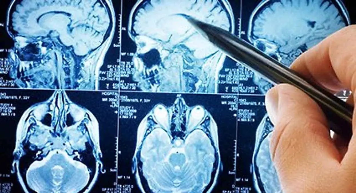 Claman por neurólogo en Cajeme