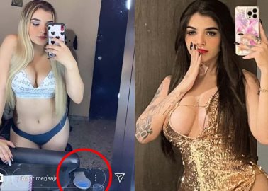 Acusan a Karely Ruiz de tener piojos