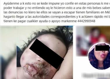 Linchan a sujeto por quemar el rostro a una bebé