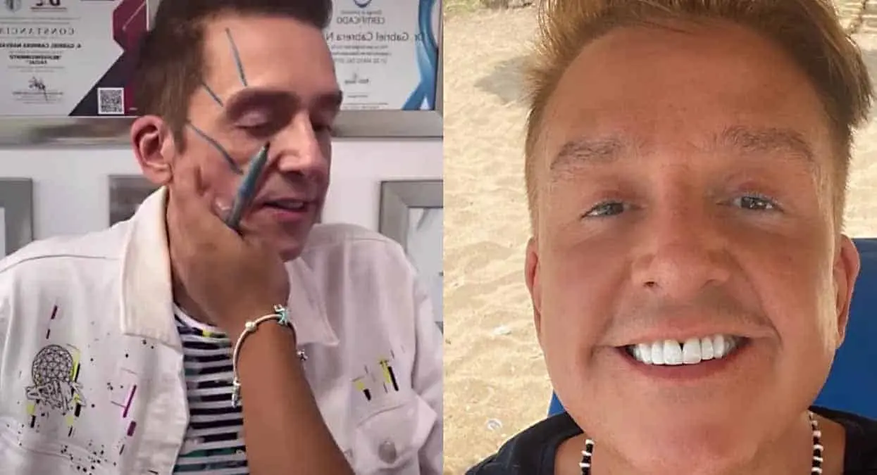 VIDEO. Daniel Bisogno luce estupendo con tratamiento facial