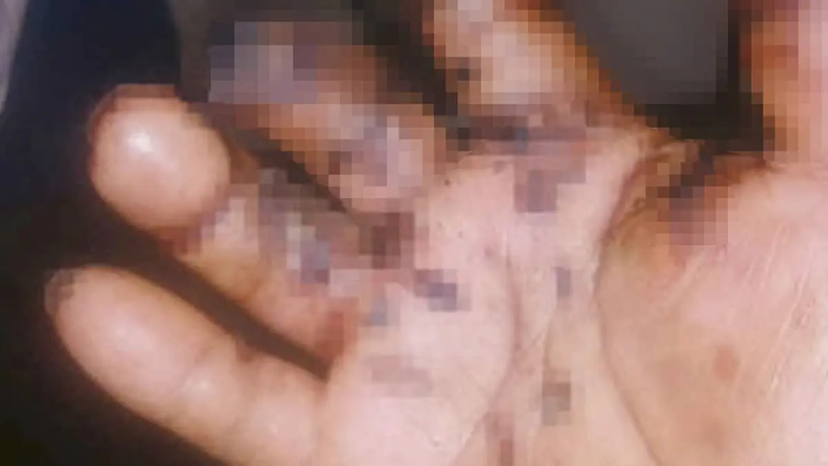 Pierde tres dedos niño que jugaba con cohetes