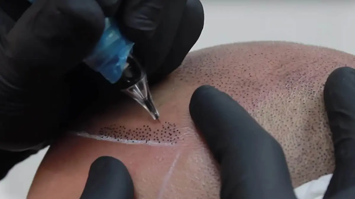 VIDEO. Se cansa de ser calvo y se tatúa un look sorprendente