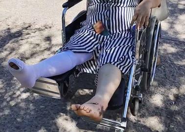 Dan de alta a mujer que fue atropellada junto a su hija y sobrino Dan de alta a mujer que fue atropellada junto a su hija y sobrino