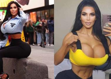 Muere mujer tras someterse a cirugía para parecerse a Kim Kardashian