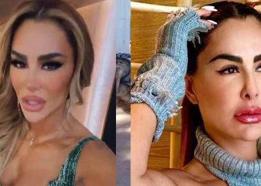 VIDEO | Ninel Conde explota contra críticas por su rostro: "La que puede, puede y la que no queso..."