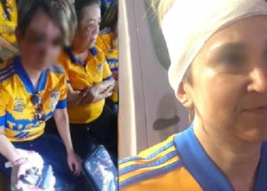 VIDEO | Pedazo de Estadio Universitario cae en la cabeza de una aficionada