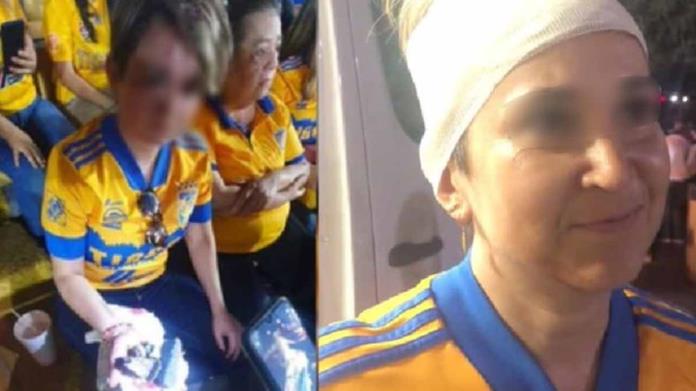 VIDEO | Pedazo de Estadio Universitario cae en la cabeza de una aficionada