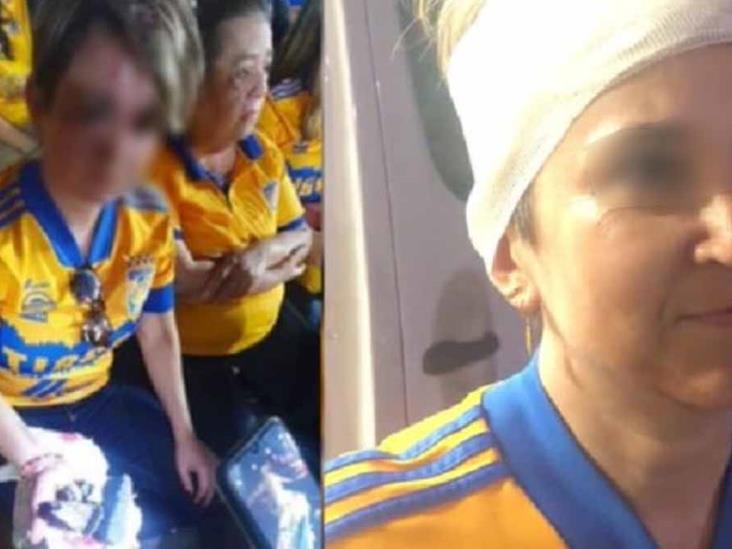 VIDEO | Pedazo de Estadio Universitario cae en la cabeza de una aficionada VIDEO | Pedazo de Estadio Universitario cae en la cabeza de una aficionada