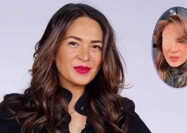 VIDEO ¦ Yolanda Andrade reaparece con parche en el ojo VIDEO ¦ Yolanda Andrade reaparece con parche en el ojo