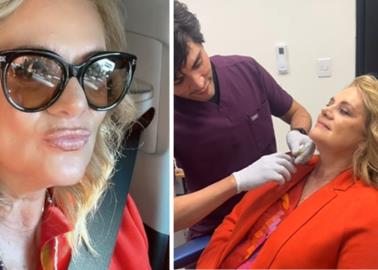 Érika Buenfil, la reina del TikTok hace "arreglos" en su cara y así luce ahora