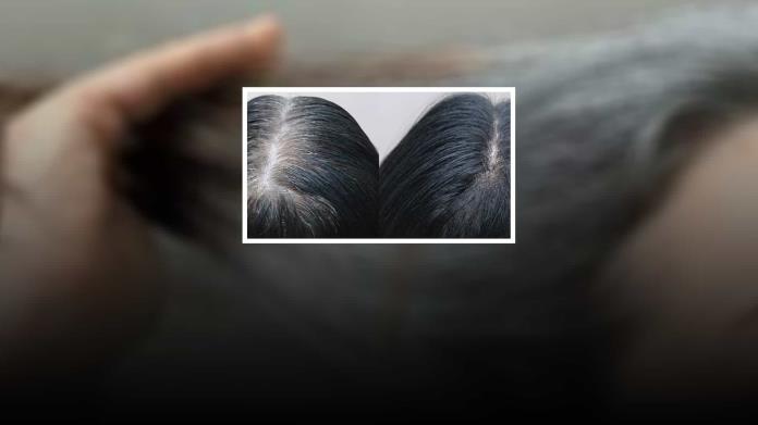 Así puedes preparar un ablandador casero de canas con solo dos ingredientes Así puedes preparar un ablandador casero de canas con solo dos ingredientes