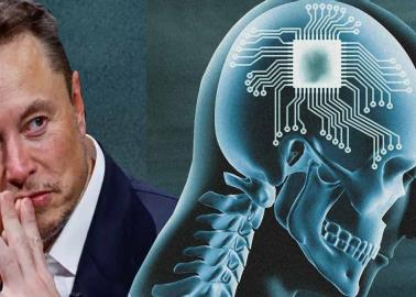 Neuralink de Elon Musk realiza implante de chip cerebral en humano