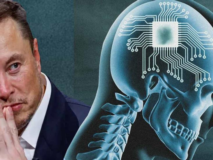 Diario Del Yaqui Neuralink De Elon Musk Realiza Implante De Chip Cerebral En Humano