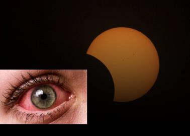 ¿Cómo saber si tus ojos fueron afectados por el eclipse solar?