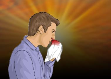 &iquest;Te sangra la nariz por el calor? Estas podr&iacute;an ser las causas