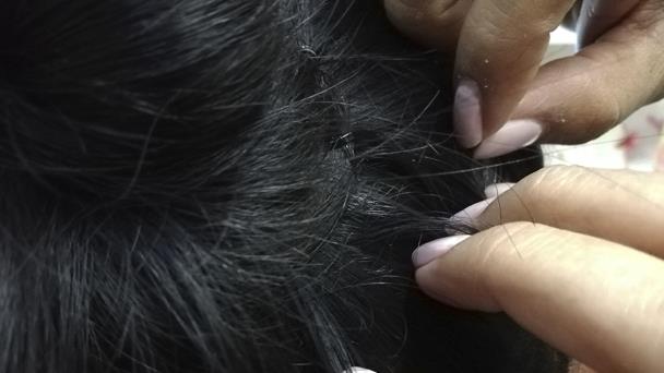 Why does my head itch when it comes to lice? Here's what science says