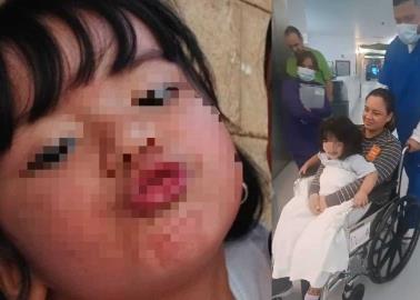 Tiene Fátima rápida recuperación 