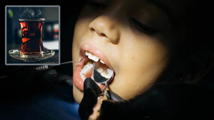 Con esta ancestral infusión podrás quitar el sarro de los dientes