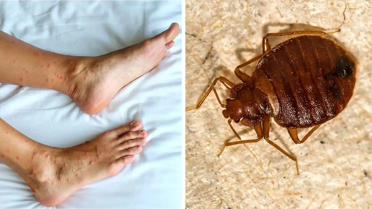¡A revisar la cama! Encuentran a las chinches superpoderosas resistentes a insecticidas