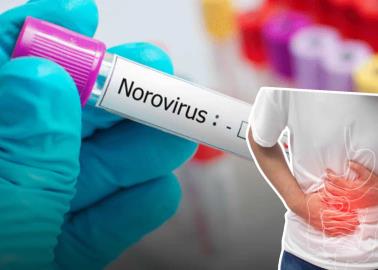 ¿Qué es el norovirus? Enfermedad que está afectando en Estados Unidos