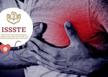 ¿Cuáles son los síntomas del Síndrome del Corazón Roto? Esto dice el Issste
