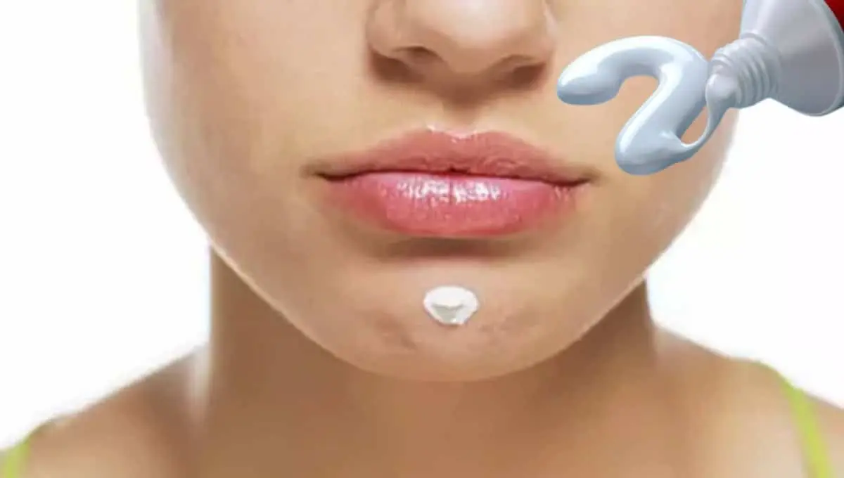 Expertos explican si funciona o no la pasta de dientes para retirar espinillas. Foto: Original