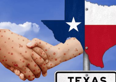 Texas en alerta por mayor brote de casos de sarampión en 30 años